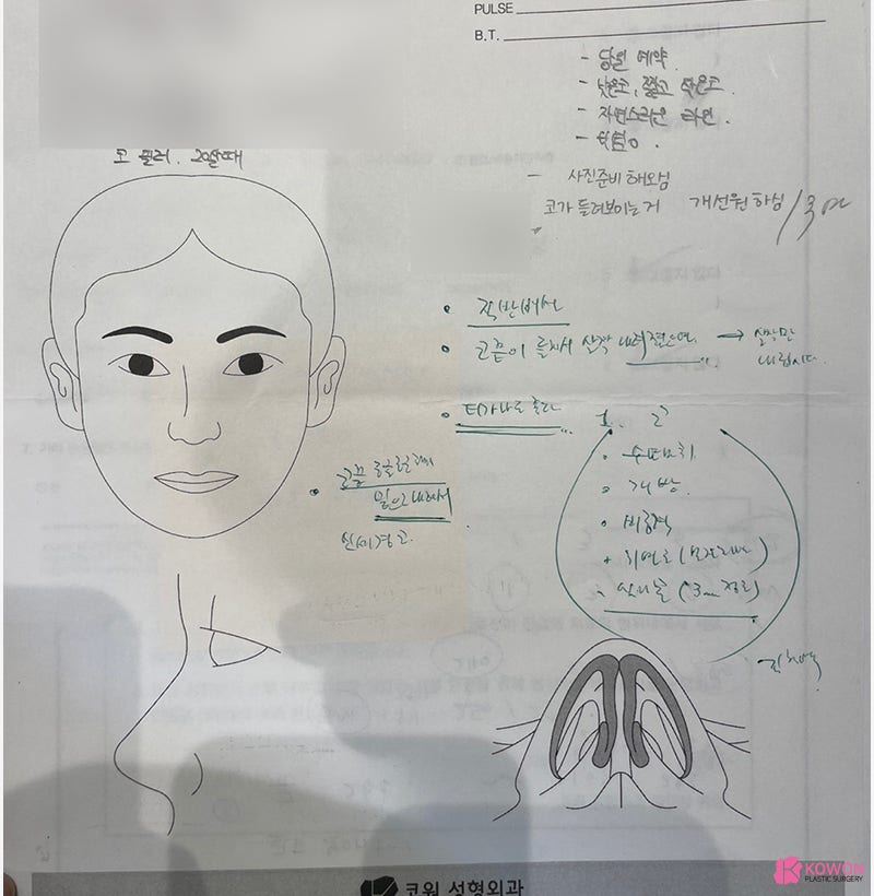 여자코성형전후 차이 짧은코수술 고민 해결