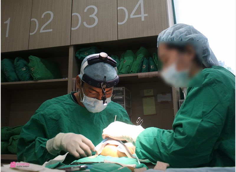 성형전문의 자가늑을 이용한 코재수술성형외과 사진 3