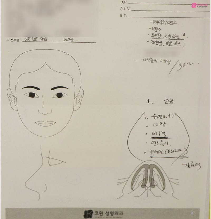 남자코수술 남성적인 이미지의 직선코성형 사진 2