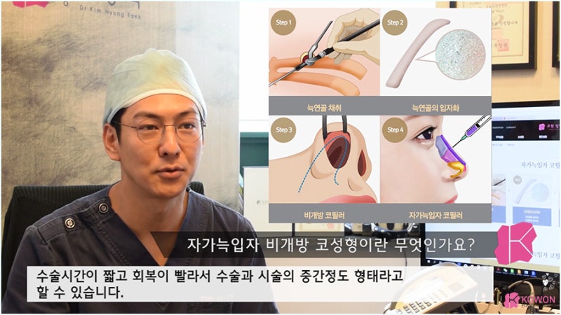 비개방코성형 염증 가능성 낮은 자가늑입자 사진 5
