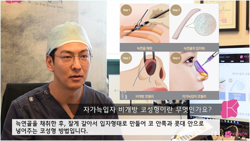 비개방코성형 염증 가능성 낮은 자가늑입자 사진 3