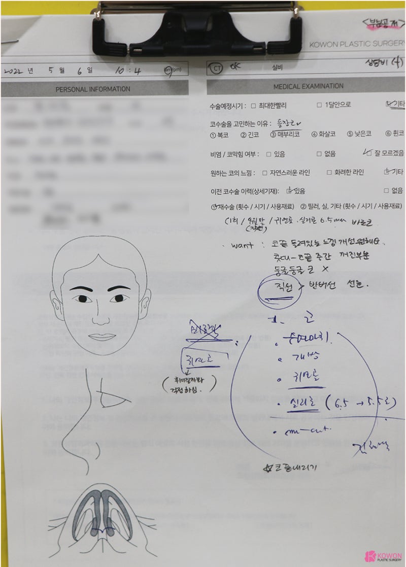코연골재수술 바비톡후기 보고 결정한 사례