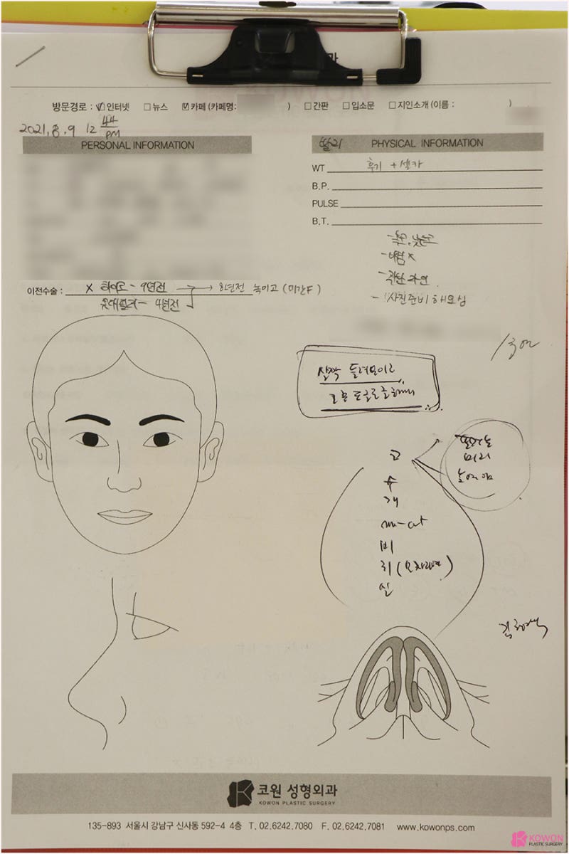 여자복코수술 비중격 교정까지 코재수술잘하는곳