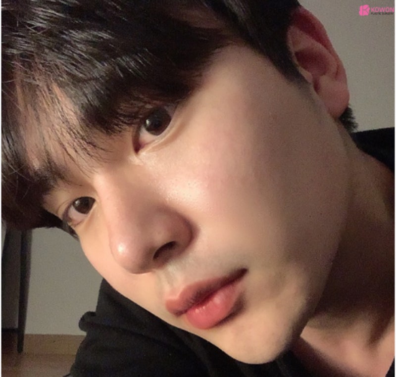 남자매부리코 수술로 옆모습못생김 콤플렉스 해결 사진 10