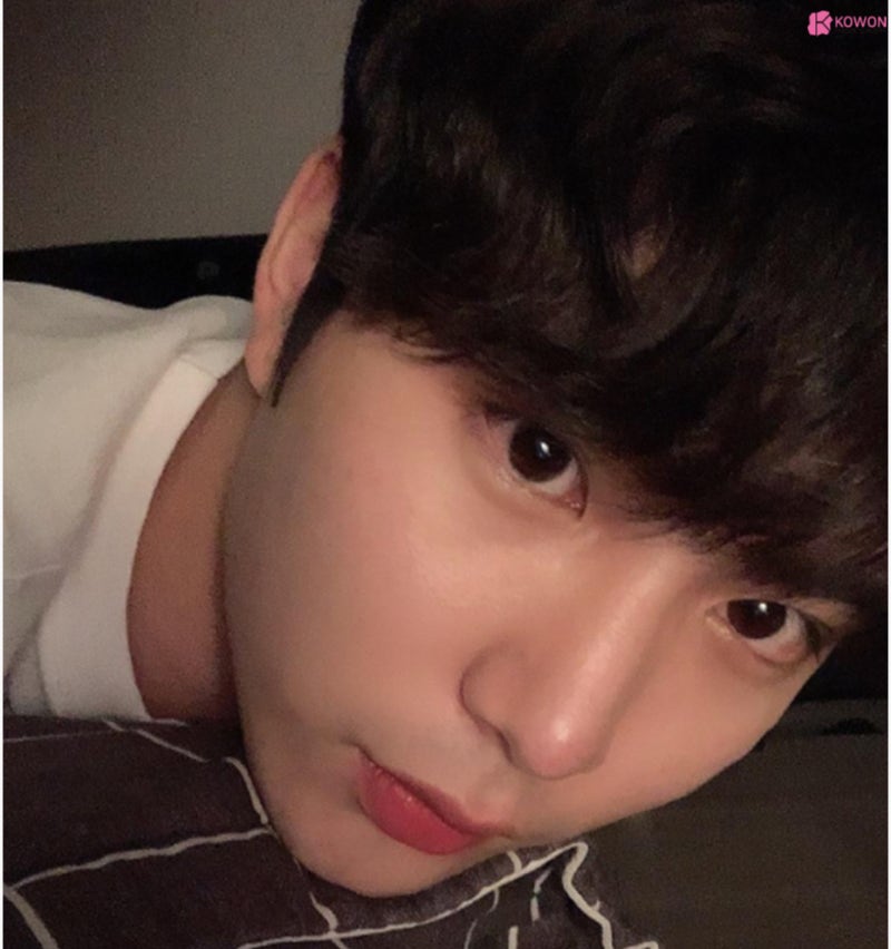 남자매부리코 수술로 옆모습못생김 콤플렉스 해결 사진 7