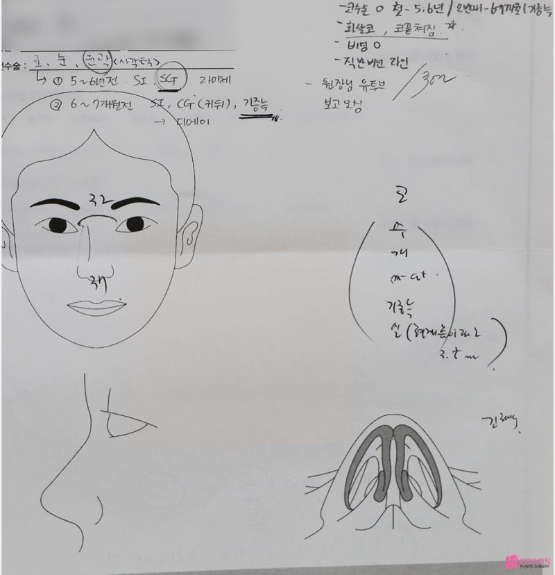 코끝처짐 재수술 세파알러지 사전 대비로 사진 3