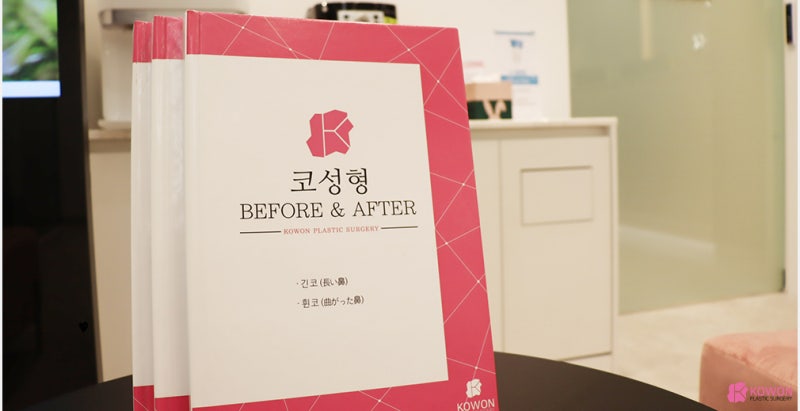 코끝처짐 재수술 세파알러지 사전 대비로