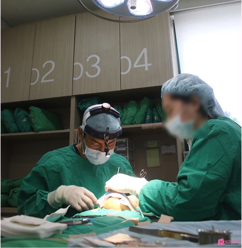 신사역코수술 자가늑연골 이용한 짧은코수술 사진 3