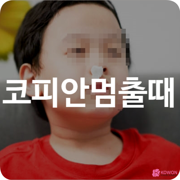코피안멈출때 응급처치 방법 및 주의사항
