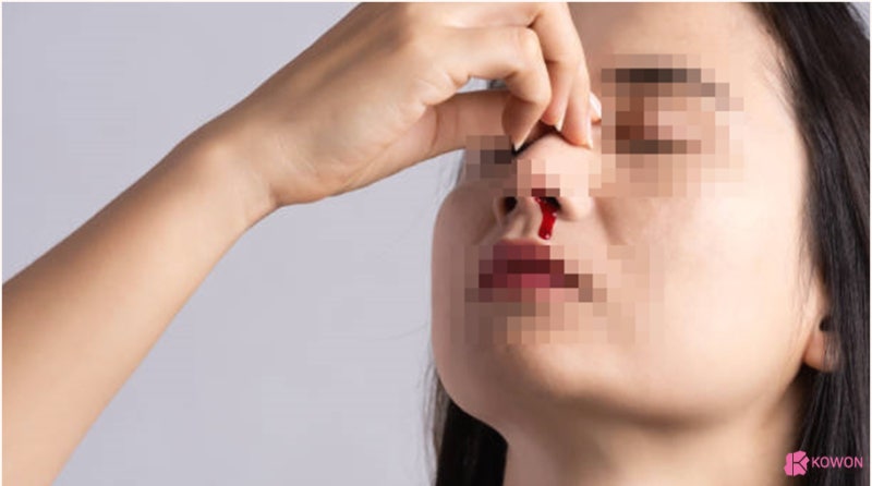 코피안멈출때 응급처치 방법 및 주의사항 사진 10