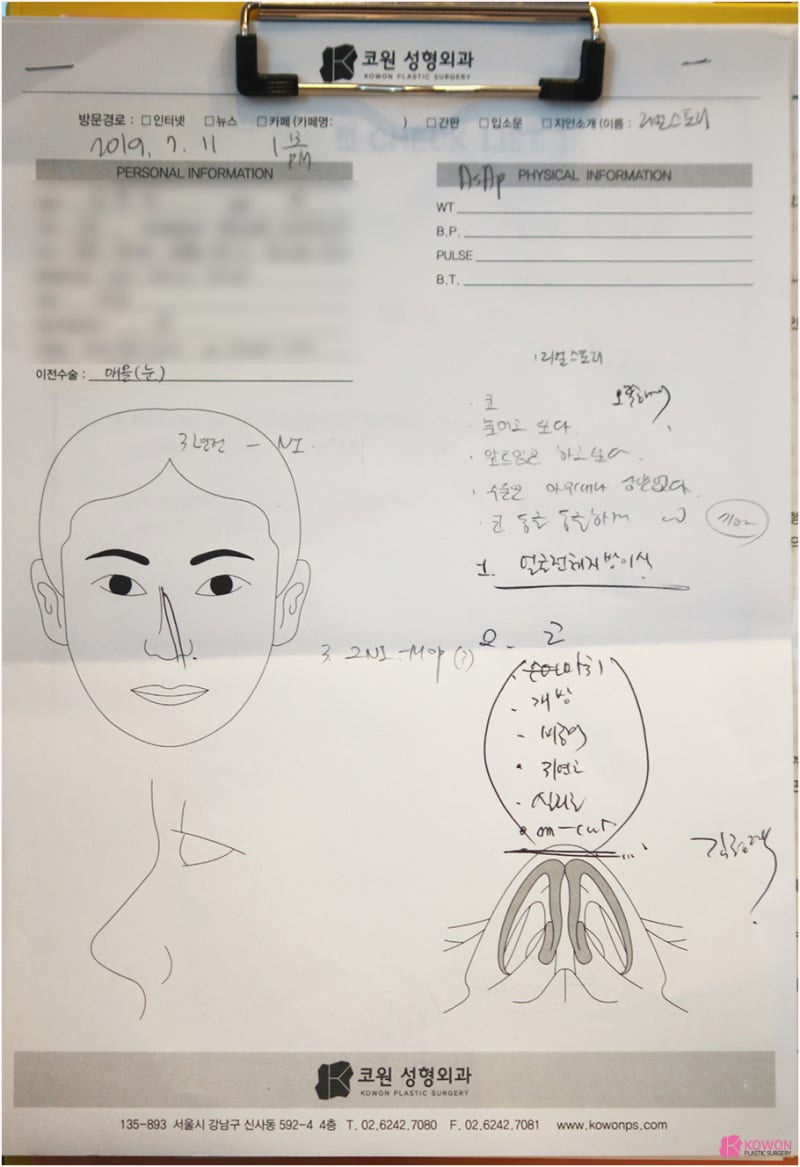코성형외과 코수술지방이식 전후 비교 사진 사진 2