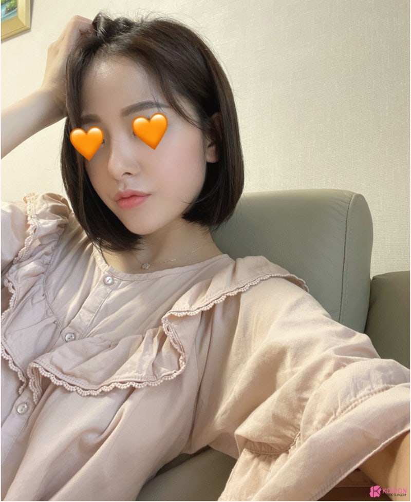 신논현역성형외과 낮고 짧은코 콤플렉스 해결 사진 13