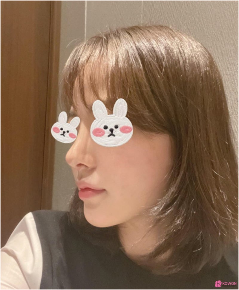 신논현역성형외과 낮고 짧은코 콤플렉스 해결 사진 6