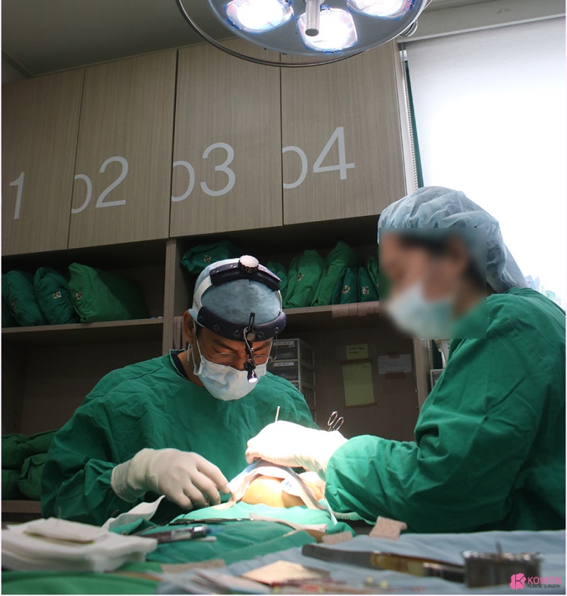 강남코수술유명한곳 자가늑으로 코수술실패 성공적으로 교정 사진 7