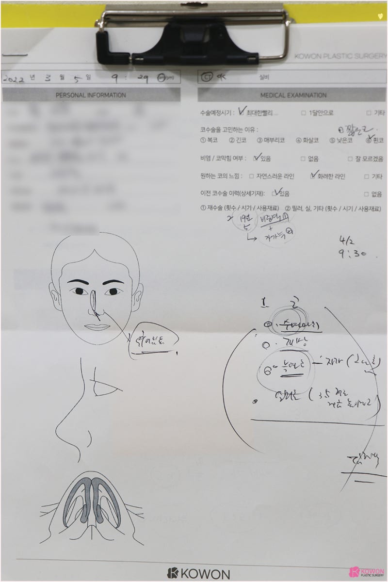 코재수술유명한곳 코성형구축 남성스러운 이미지로