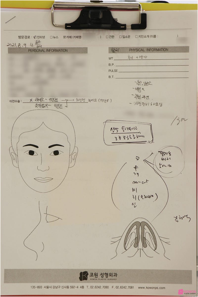 강남코성형잘하는곳 기능코수술 전후 사진