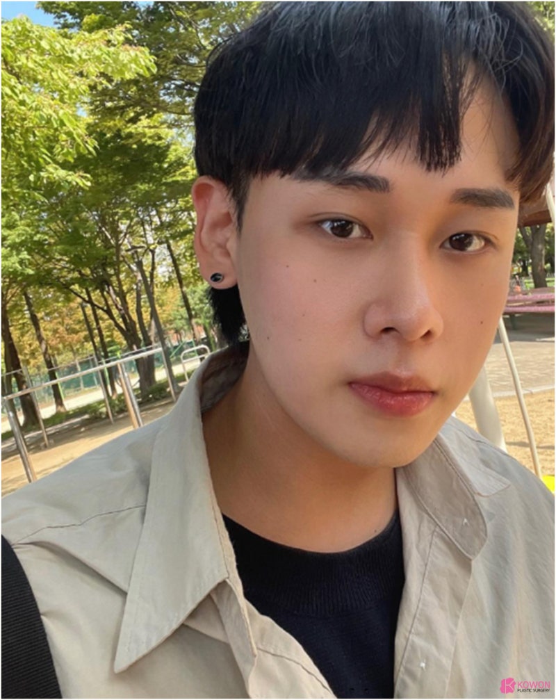 신사성형외과 남자 비염코수술 사례 사진 9
