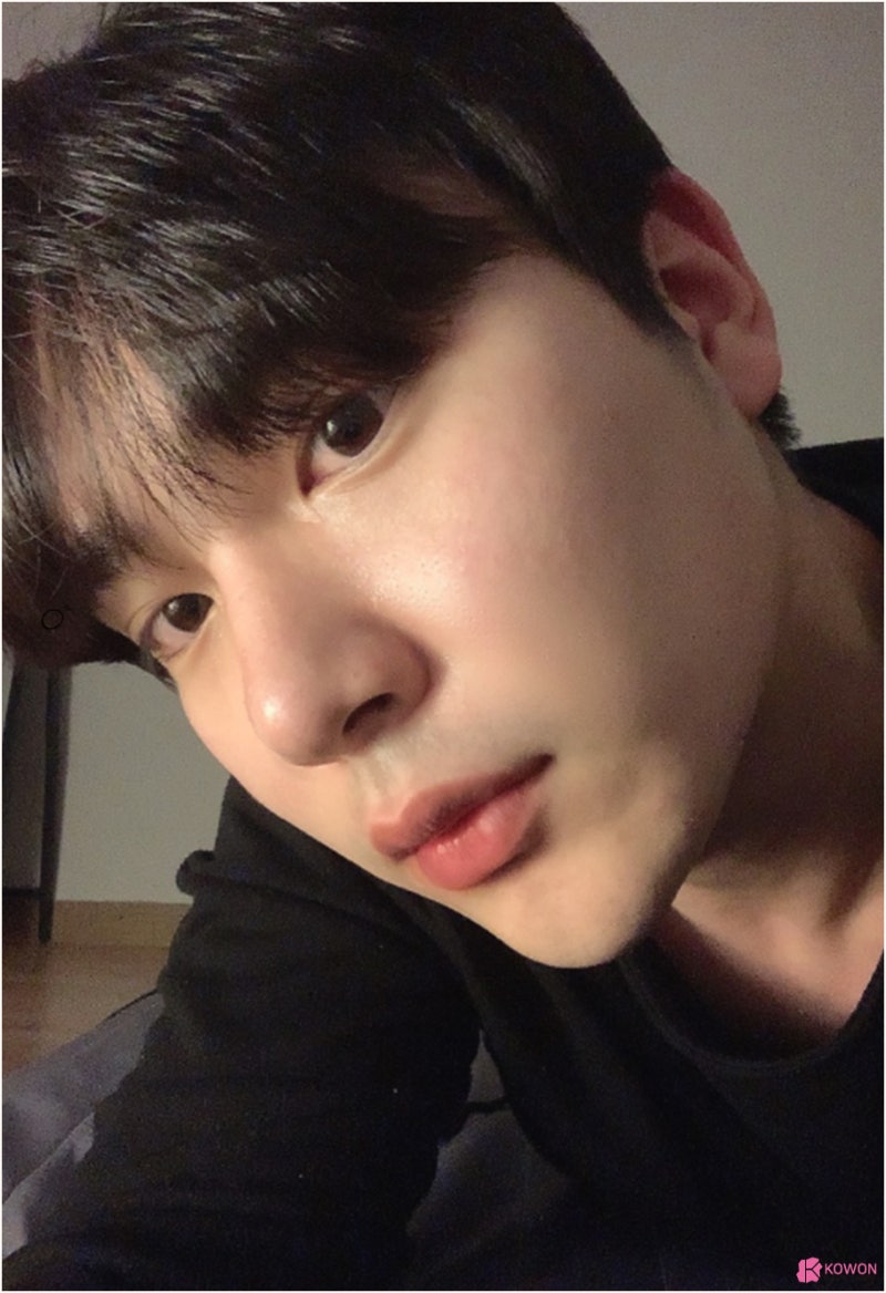압구정코성형 비중격교정술 매부리코 콤플렉스 해결 사진 10
