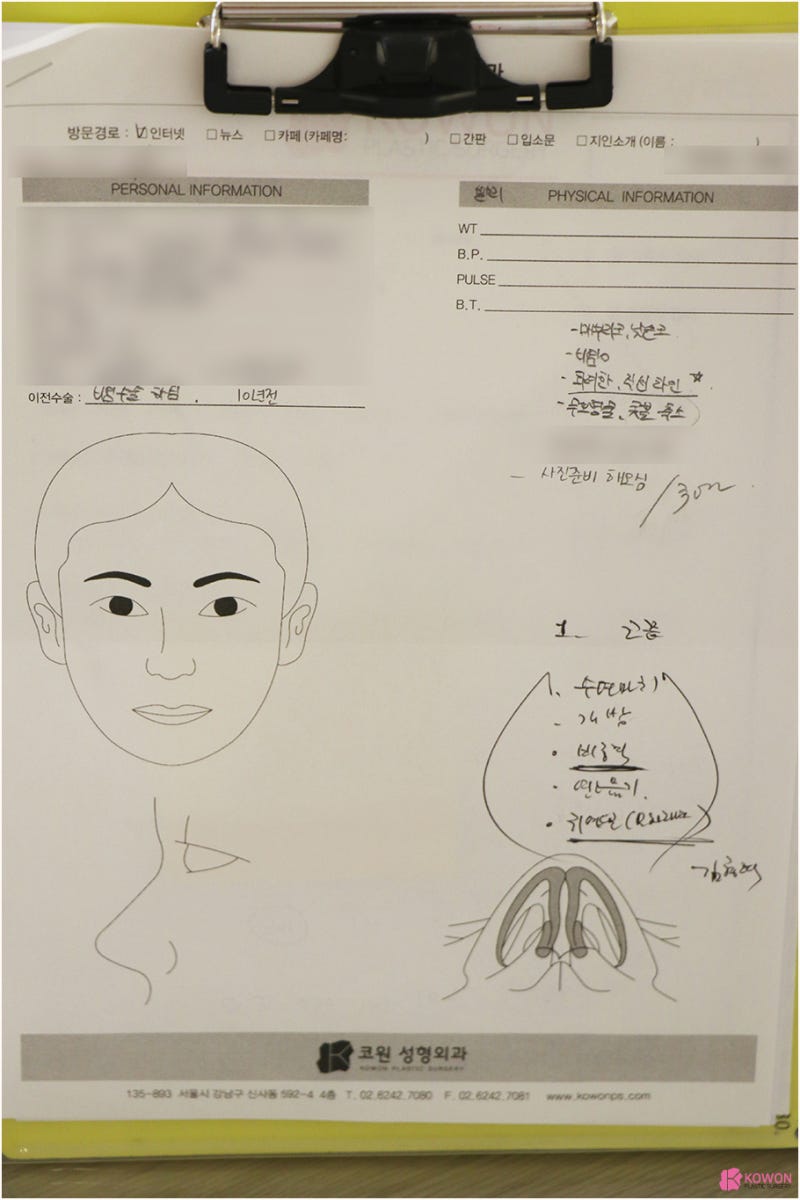 압구정코성형 비중격교정술 매부리코 콤플렉스 해결 사진 2