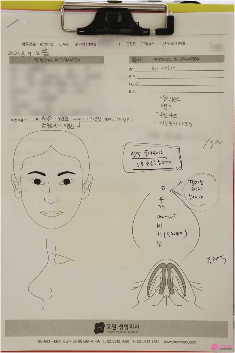 기능코성형외과 콧대높이기 수술 후 경과