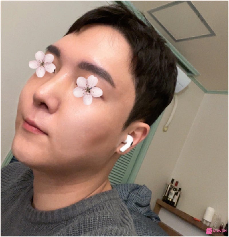 코재수술병원 휘어진 코 코끝구축 교정도 자연스럽게 사진 6