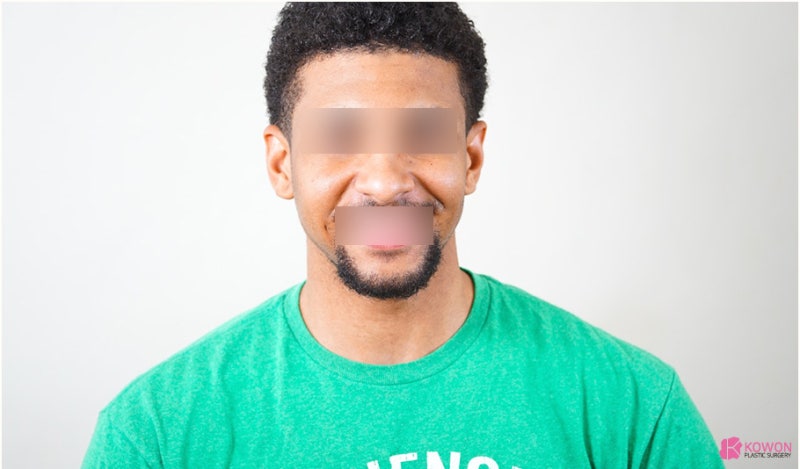 코관상 모양 방향에 따른 풀이 해석 사진 8