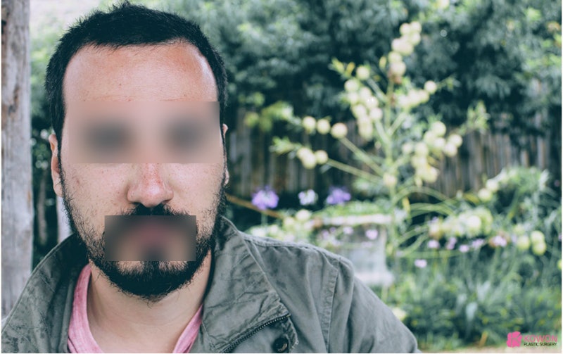 코관상 모양 방향에 따른 풀이 해석 사진 4