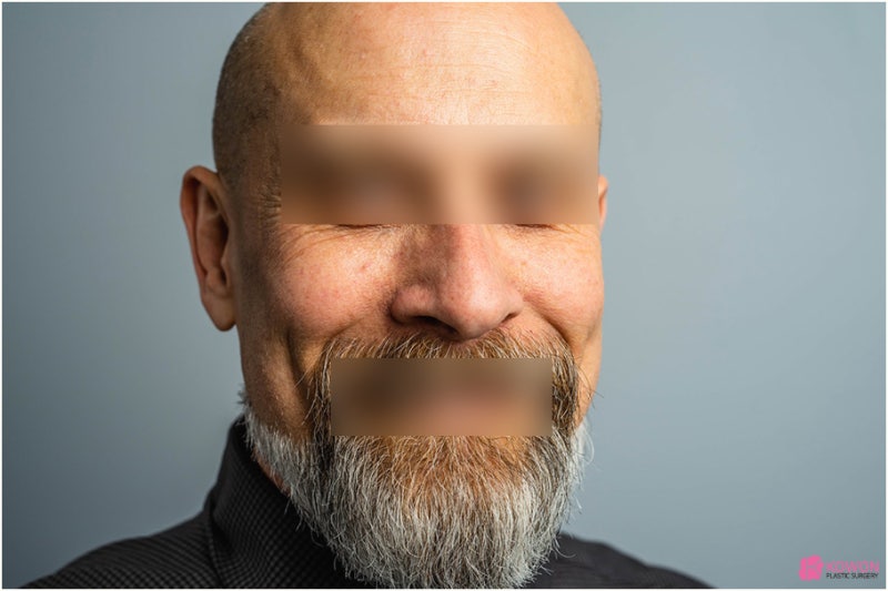 코관상 모양 방향에 따른 풀이 해석 사진 7
