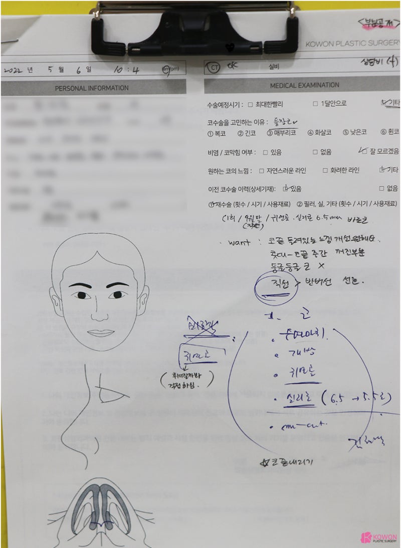 코수술잘하는곳 남자 코끝들림 직선코 라인으로