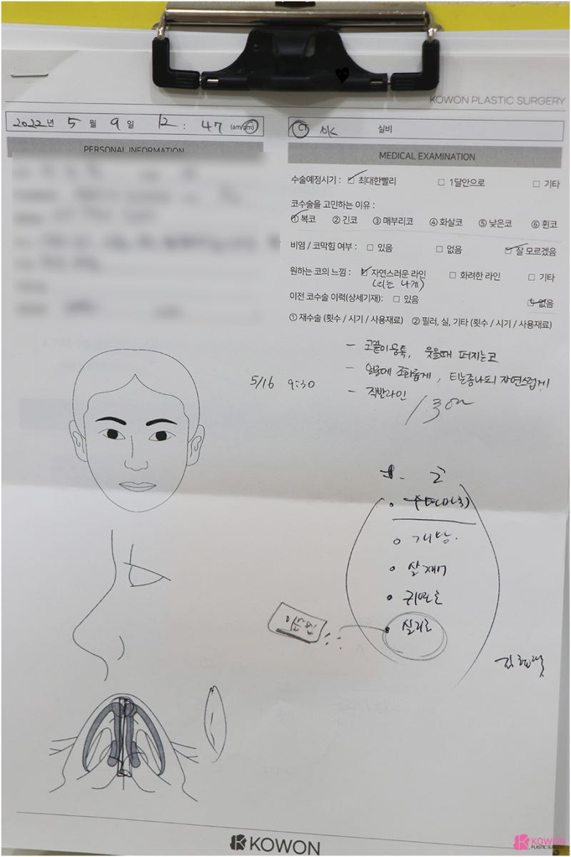 코성형외과유명한곳 동글동글한코 콤플렉스 해결
