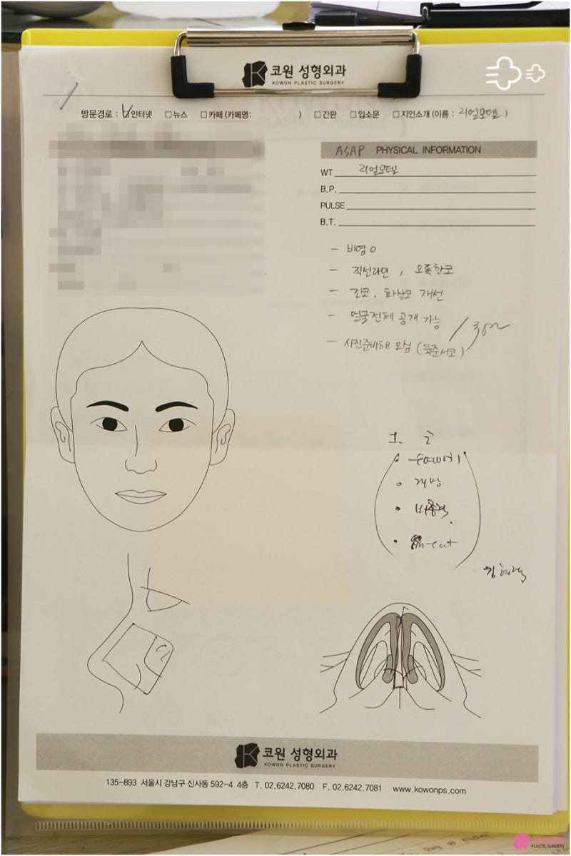 강남코수술잘하는곳 뭉툭한코 수술 후기