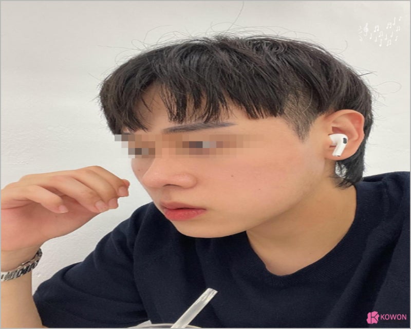 강남코수술잘하는곳 뭉툭한코 수술 후기 사진 11