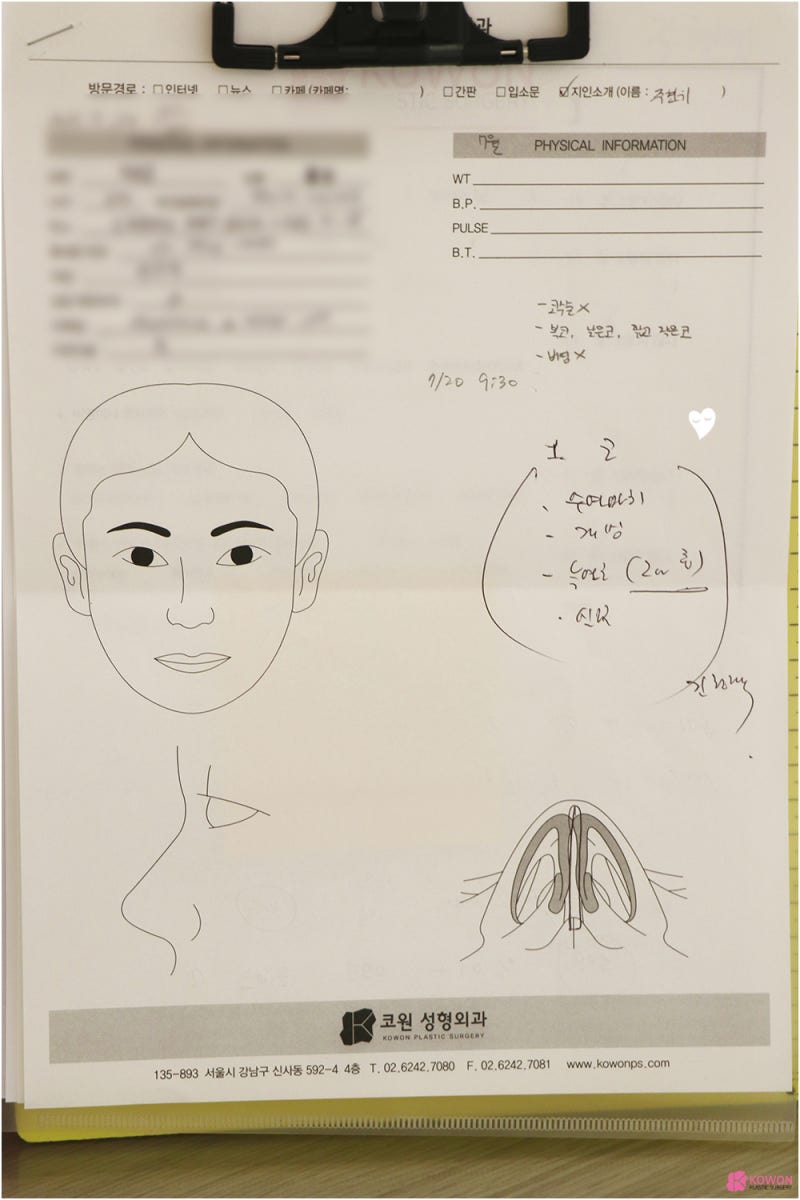 코성형병원 남자 복코전후 비교 사진