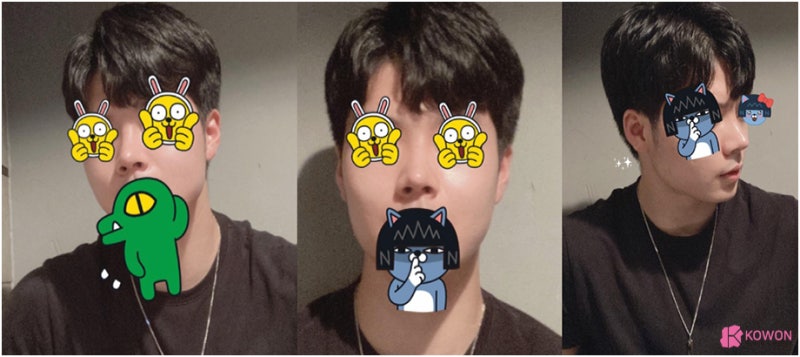 코성형병원 남자 복코전후 비교 사진 사진 7