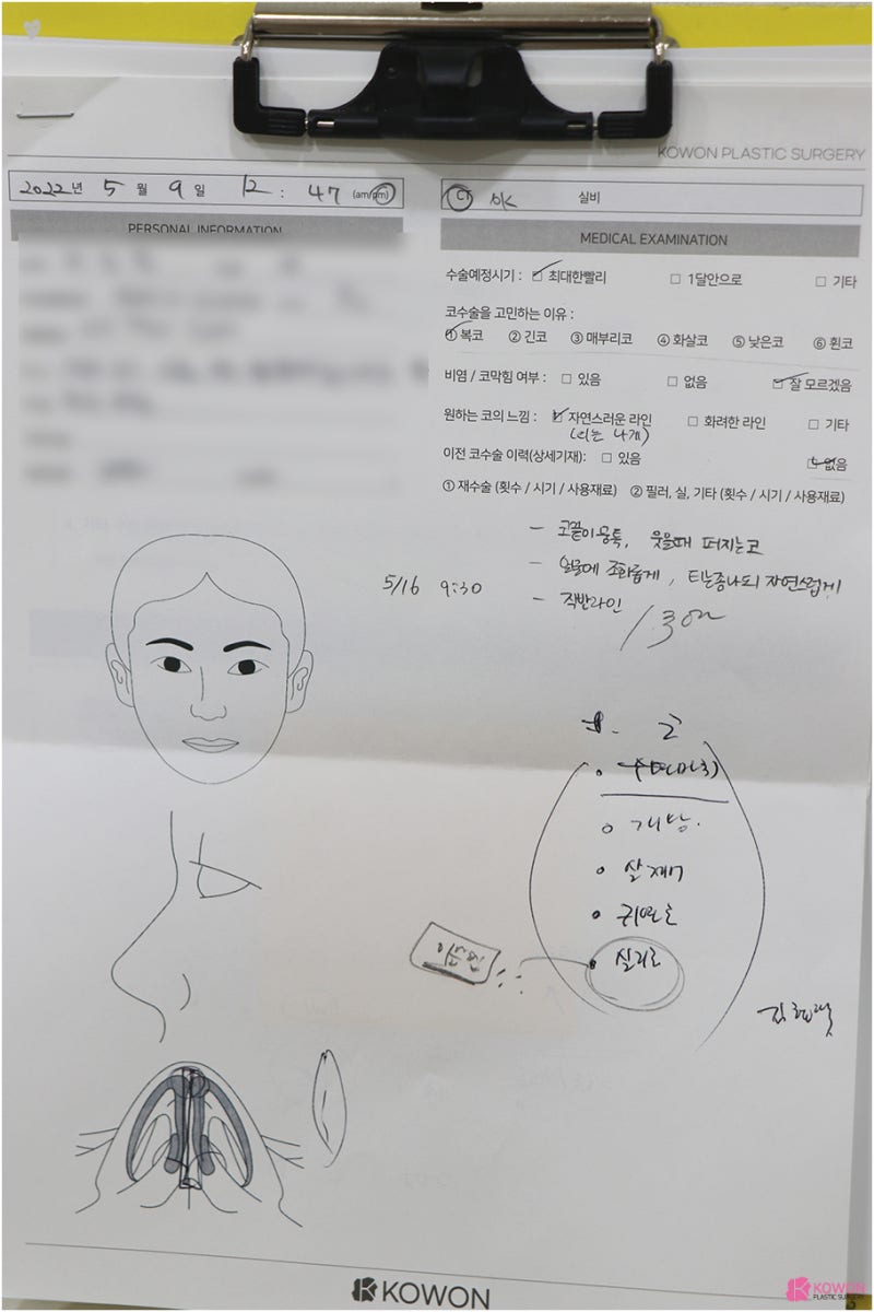 복코수술전후 코끝살 올리고 인중 라인까지 예쁘게