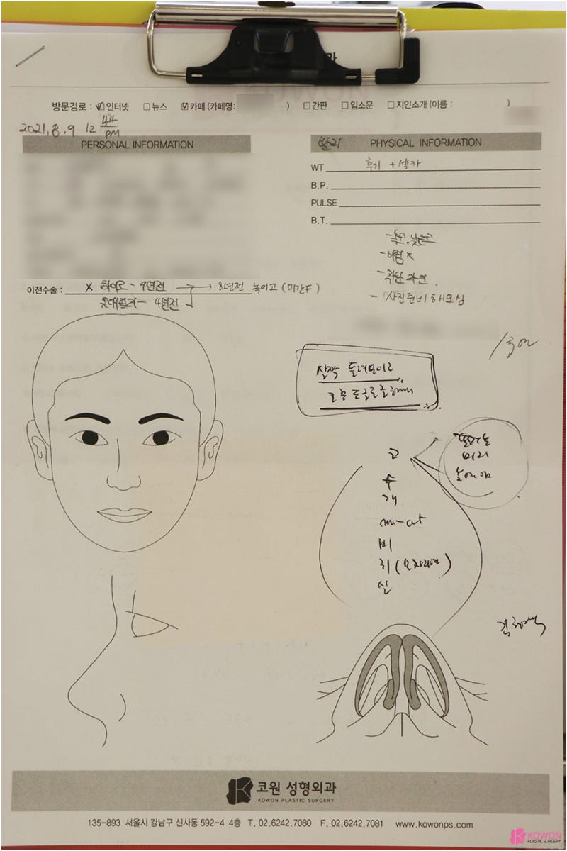 신사역성형외과 비중격휨 증상 교정 전후 사진