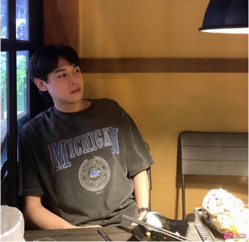 논현동성형외과 높은콧대 만들고 세련된 이미지로 사진 9