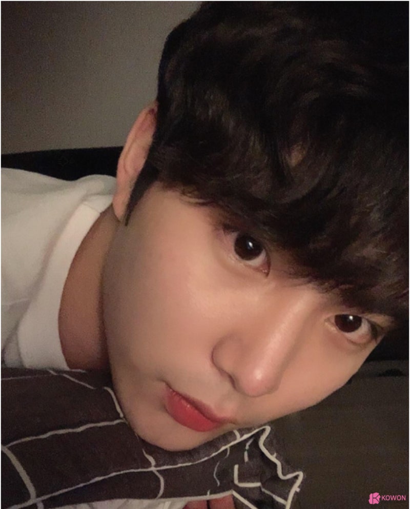 신사역코성형 코끝 모양 보완한 무보형물코수술후기 사진 7