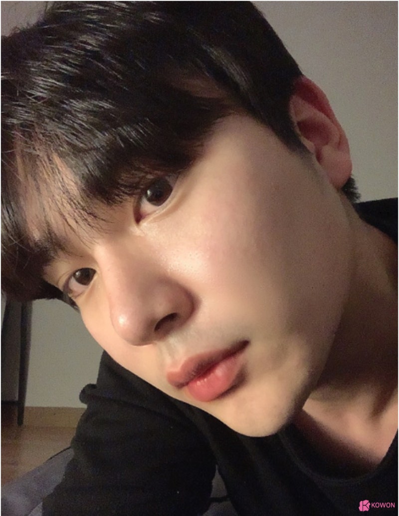 신사역코성형 코끝 모양 보완한 무보형물코수술후기 사진 10