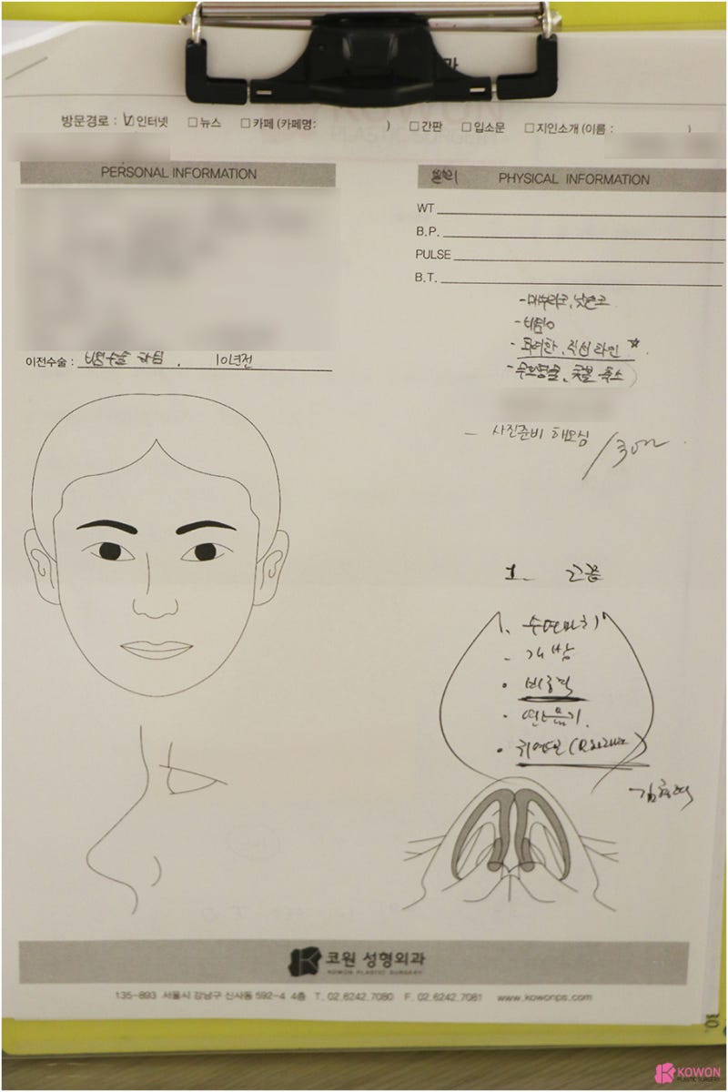 신사역코성형 코끝 모양 보완한 무보형물코수술후기 사진 2