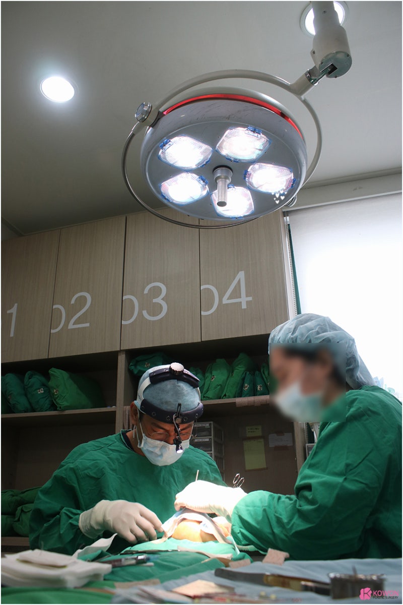 코성형전문성형외과 매부리코부작용 재수술 사례 사진 3