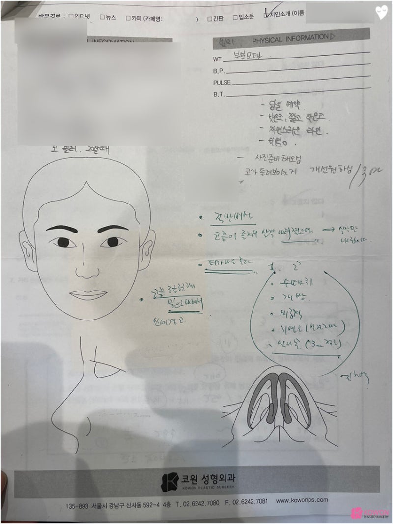 코성형잘하는곳추천 신세경코 여성스러운 이미지를 원한다면
