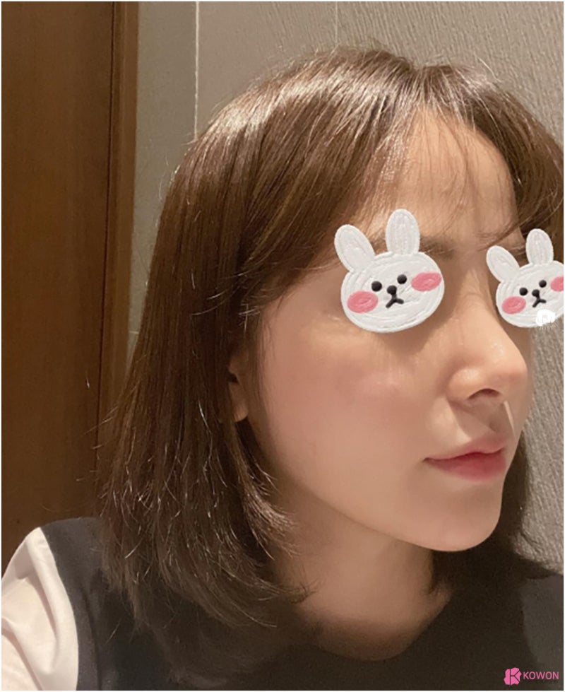 코성형잘하는곳추천 신세경코 여성스러운 이미지를 원한다면 사진 5