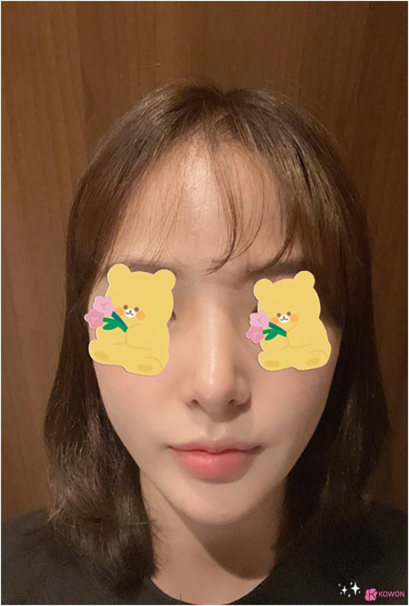 코성형잘하는곳추천 신세경코 여성스러운 이미지를 원한다면 사진 7