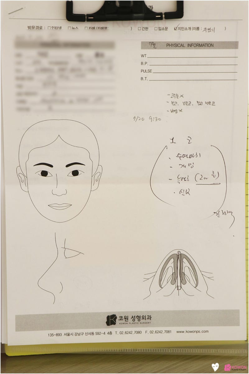 코성형유명한병원 자가 늑연골 활용한 남자복코수술 통해 개선