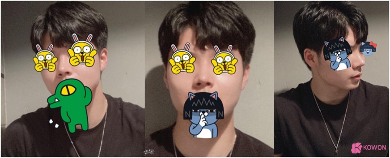 코성형유명한병원 자가 늑연골 활용한 남자복코수술 통해 개선 사진 7