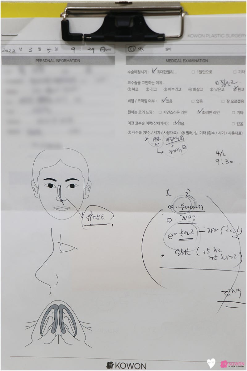 코성형병원 코수술후구축 교정으로 문제 해결