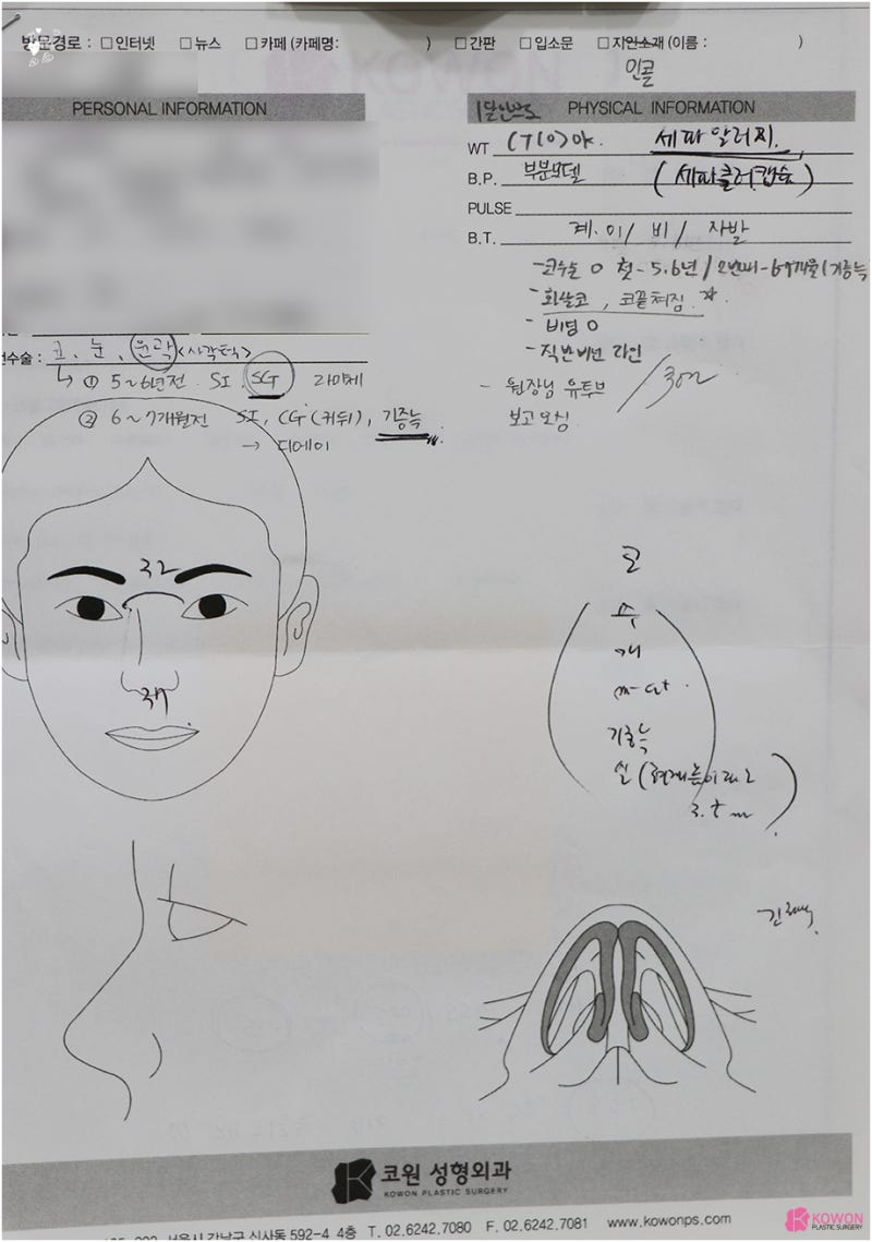 압구정역근처성형외과 알레르기 대비 처진코 수술