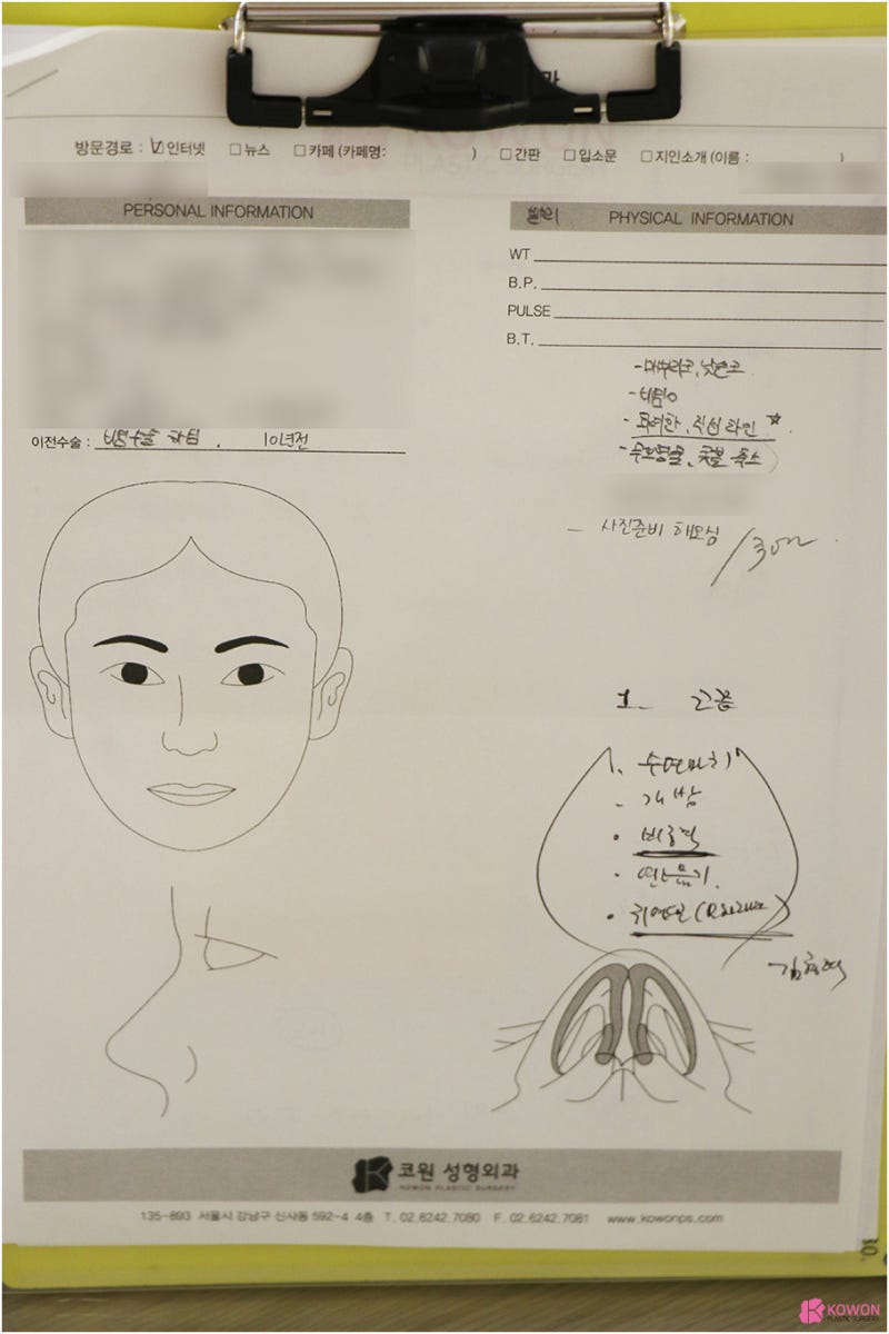 코성형전문의 매부리코수술 남자 환자 사례
