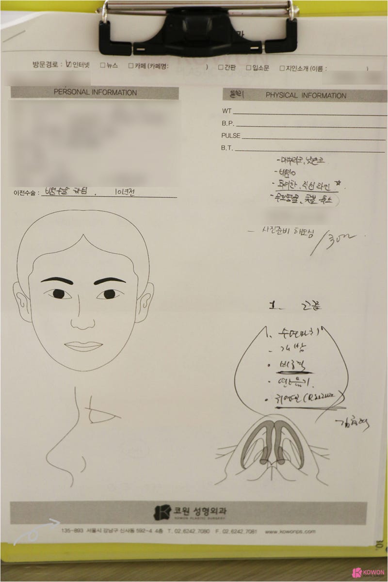 강남성형외과추천 그루밍족 남자매부리코성형 사례